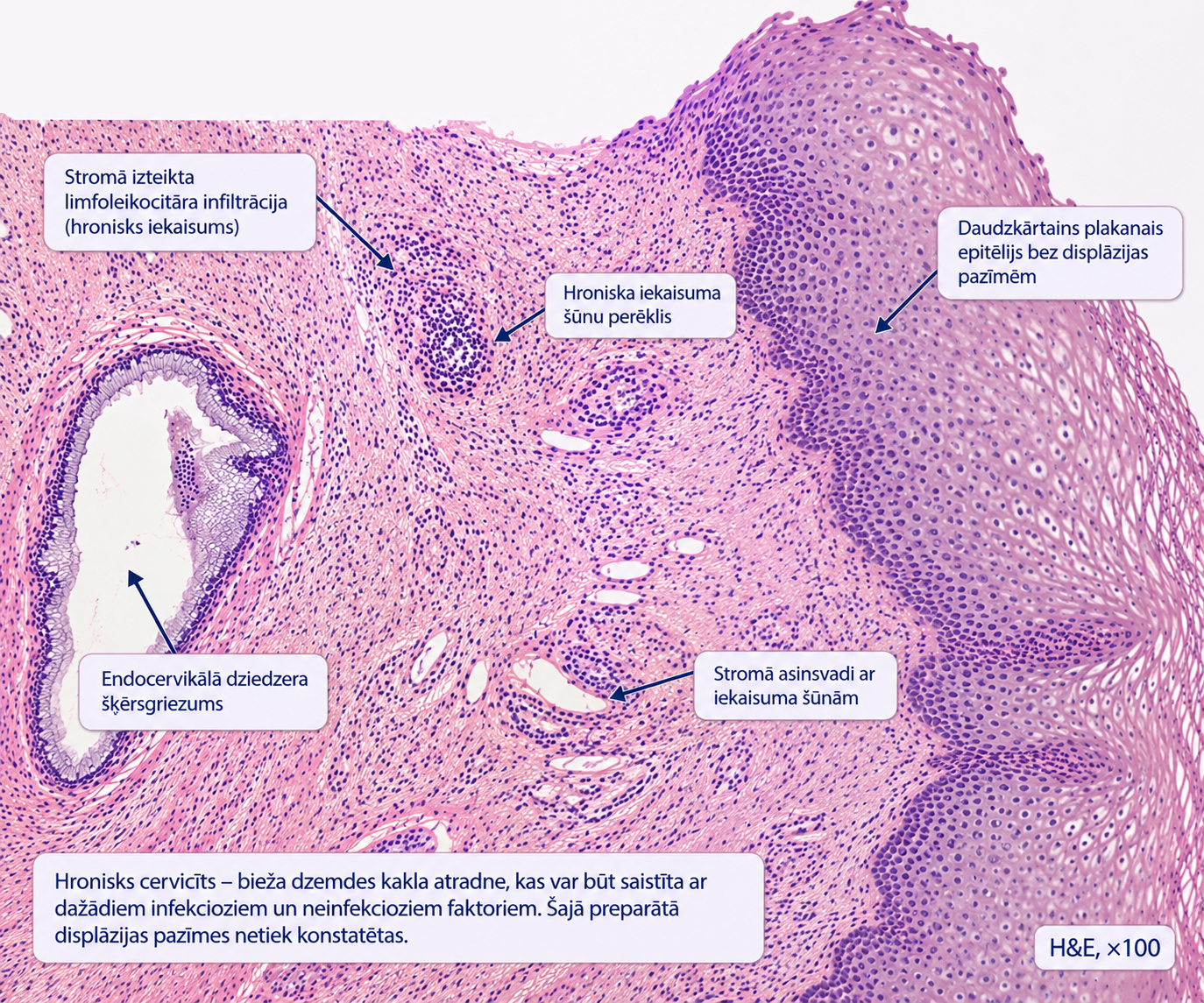 2023-gada-biopsijas-histologiska-atrade