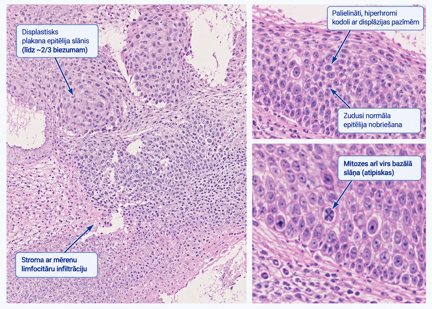 2026-gada-biopsijas-histologiska-atrade-he-krasojuma