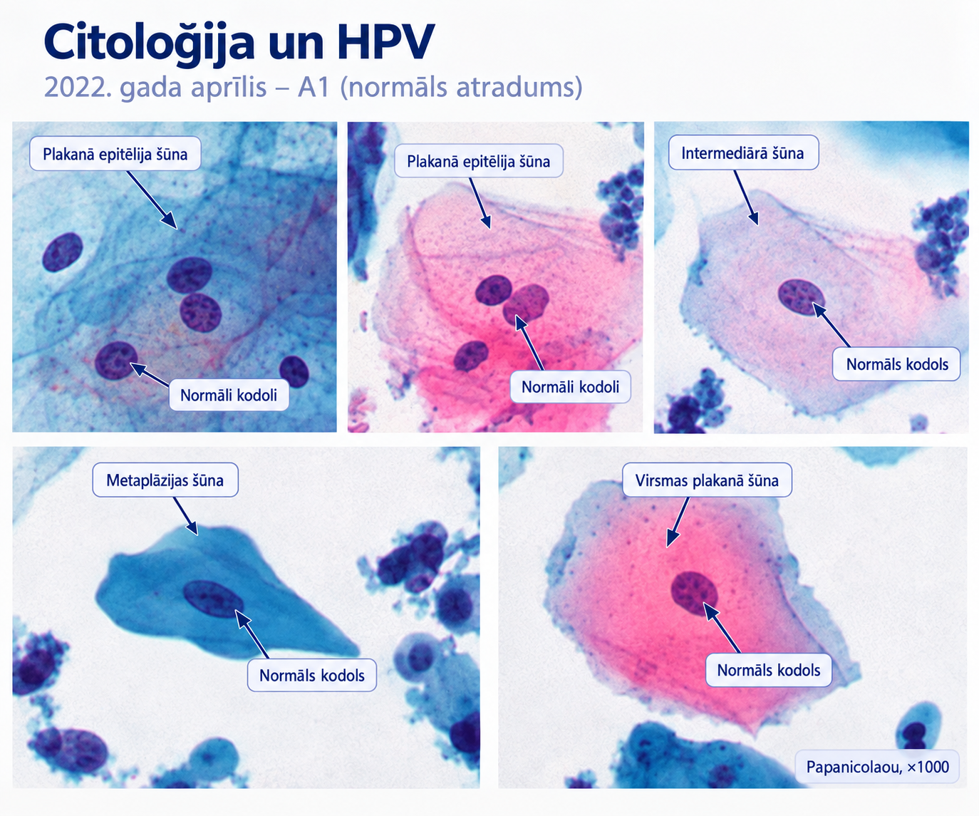 Histoloģija - citoloģija un HPV